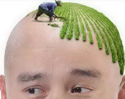 X植发等于生发